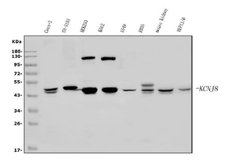 Kir6.1/KCNJ8 Rabbit Polyclonal Antibody