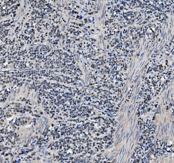 METTL1 Rabbit Polyclonal Antibody