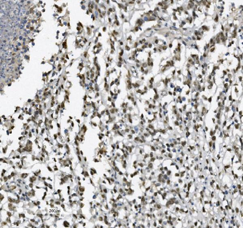 METTL1 Rabbit Polyclonal Antibody