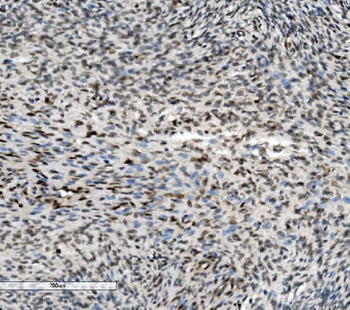 METTL1 Rabbit Polyclonal Antibody