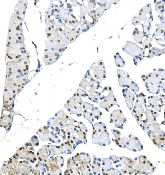 METTL1 Rabbit Polyclonal Antibody