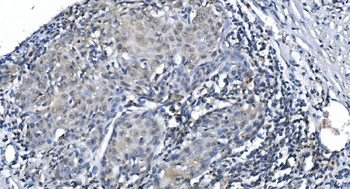 METTL3 Rabbit Polyclonal Antibody