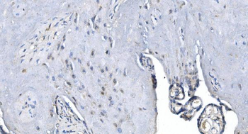 METTL3 Rabbit Polyclonal Antibody