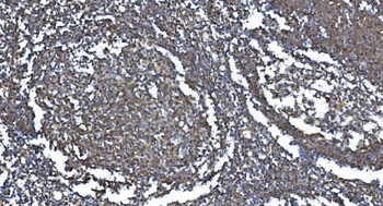 METTL3 Rabbit Polyclonal Antibody
