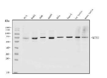 METTL3 Rabbit Polyclonal Antibody