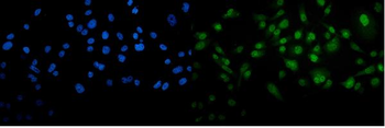 METTL3 Rabbit Polyclonal Antibody