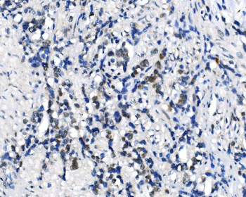 METTL3 Rabbit Polyclonal Antibody