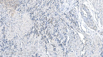 METTL3 Rabbit Polyclonal Antibody