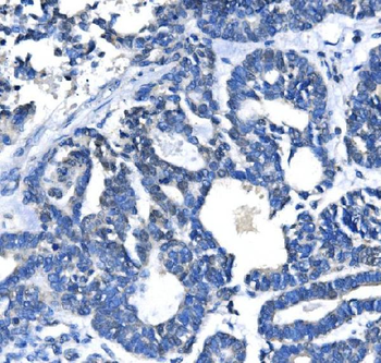 METTL3 Rabbit Polyclonal Antibody