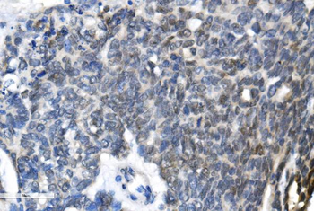 METTL3 Rabbit Polyclonal Antibody