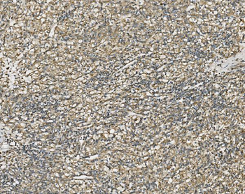 NDUFB10 Rabbit Polyclonal Antibody