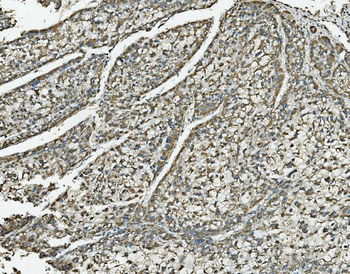 NDUFB10 Rabbit Polyclonal Antibody