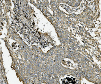 NDUFB10 Rabbit Polyclonal Antibody