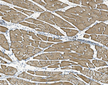 NDUFB10 Rabbit Polyclonal Antibody