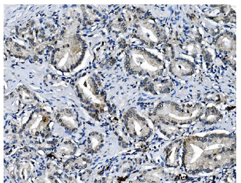 PCBP1 Antibody