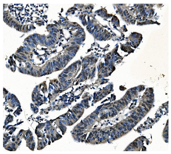 PCBP1 Antibody