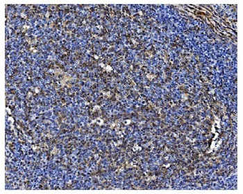 PCBP1 Antibody
