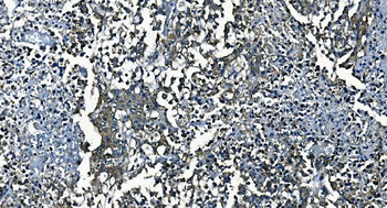 PCBP2/hnRNP E2 Rabbit Polyclonal Antibody