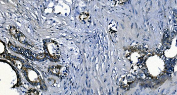PCBP2/hnRNP E2 Rabbit Polyclonal Antibody