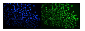 SPAK/STK39 Rabbit Polyclonal Antibody
