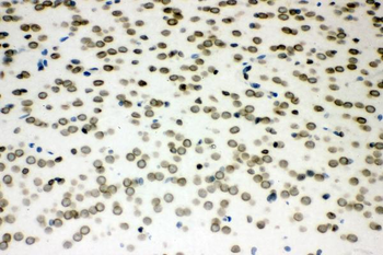 Sumo 1/SUMO1 Antibody