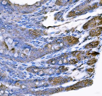 Tspan-8/Tspan8 Rabbit Polyclonal Antibody