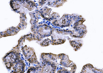 Tspan-8/Tspan8 Rabbit Polyclonal Antibody