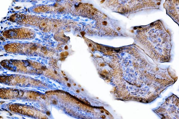 Tspan-8/Tspan8 Rabbit Polyclonal Antibody