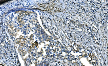 UBE2D1/2/3/4 Antibody