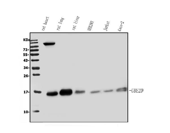 UBE2D1/2/3/4 Antibody