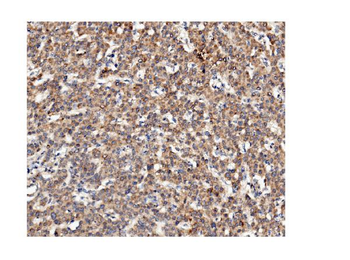 ch TOG/CKAP5 Mouse Monoclonal Antibody