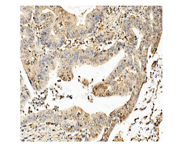 ch TOG/CKAP5 Mouse Monoclonal Antibody