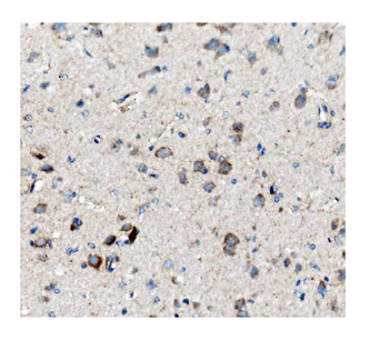 ch TOG/CKAP5 Mouse Monoclonal Antibody