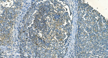 IDH2 Antibody (monoclonal, 2H4)