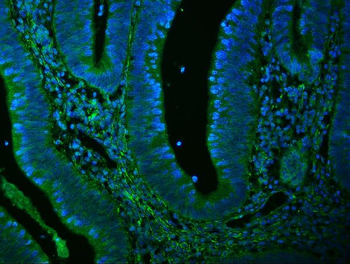 Filamin A/FLNA Antibody (monoclonal, 3F8)