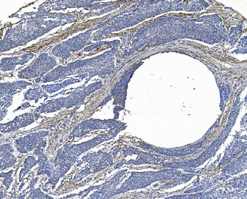 Filamin A/FLNA Antibody (monoclonal, 3F8)