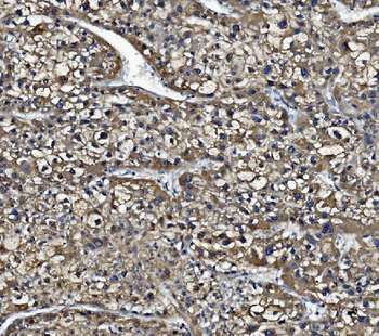 Liver Carboxylesterase 1/CES1 Mouse Monoclonal Antibody