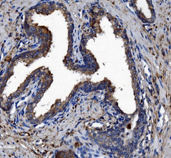 Liver Carboxylesterase 1/CES1 Mouse Monoclonal Antibody