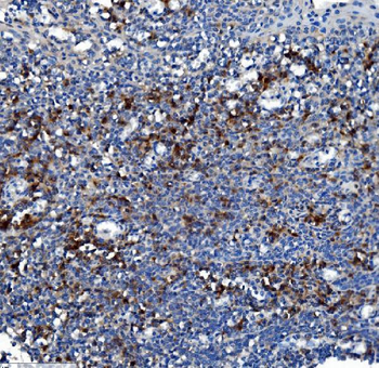 Liver Carboxylesterase 1/CES1 Mouse Monoclonal Antibody