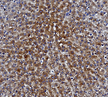 Liver Carboxylesterase 1/CES1 Mouse Monoclonal Antibody