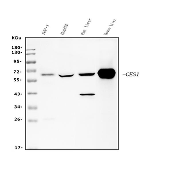Liver Carboxylesterase 1/CES1 Mouse Monoclonal Antibody