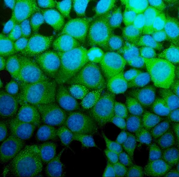 ASS1 Antibody (monoclonal, 5I5)