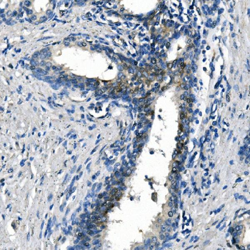 ASS1 Antibody (monoclonal, 5I5)