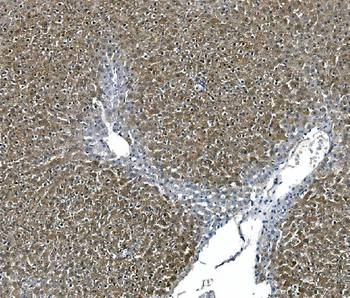 ASS1 Antibody (monoclonal, 5I5)