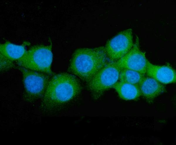 ASS1 Antibody (monoclonal, 7I9)