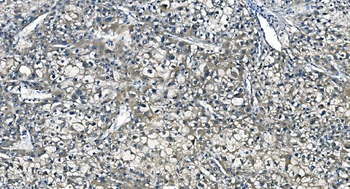 ASS1 Antibody (monoclonal, 7I9)