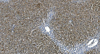 ASS1 Antibody (monoclonal, 7I9)