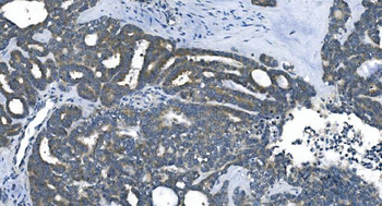 eRF1/ETF1 Mouse Monoclonal Antibody