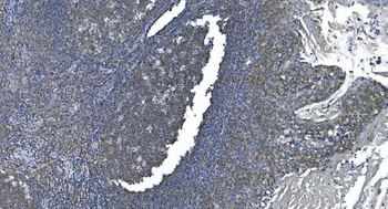 eRF1/ETF1 Mouse Monoclonal Antibody