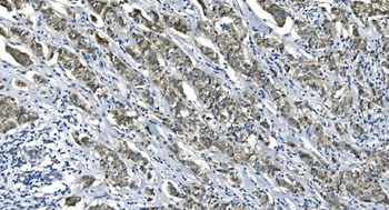 eRF1/ETF1 Mouse Monoclonal Antibody